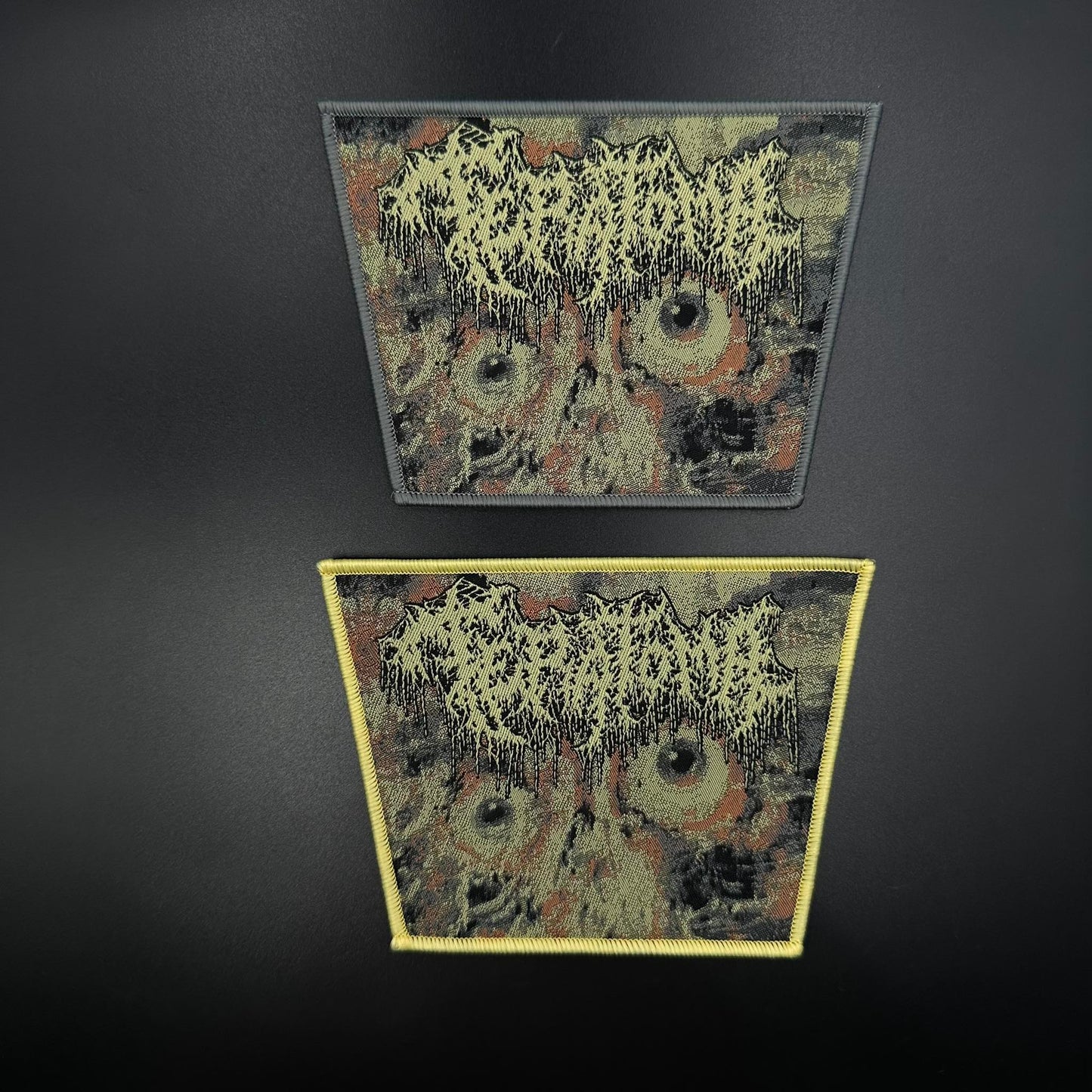 Teratoma - Purulent Manifestations