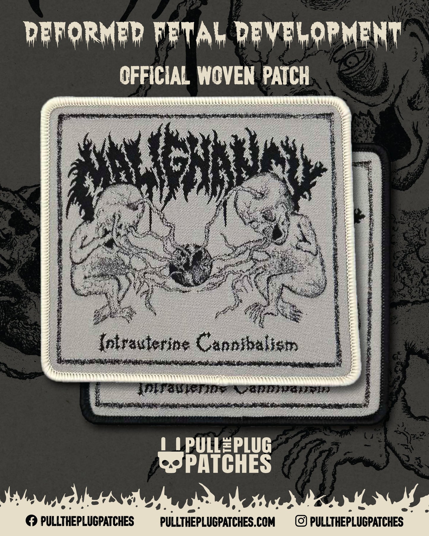 Malignancy - Intrauterine Cannibalism - Patch