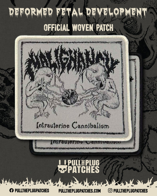 Malignancy - Intrauterine Cannibalism - Patch